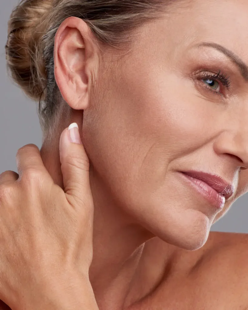 Laser Skin Resurfacing in Delray Beach, FL