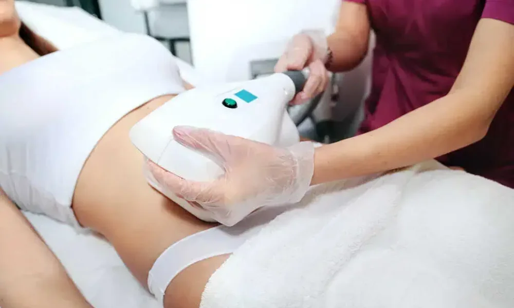 CoolSculpting Elite Session by Dash Medical Spa in Beach, FL