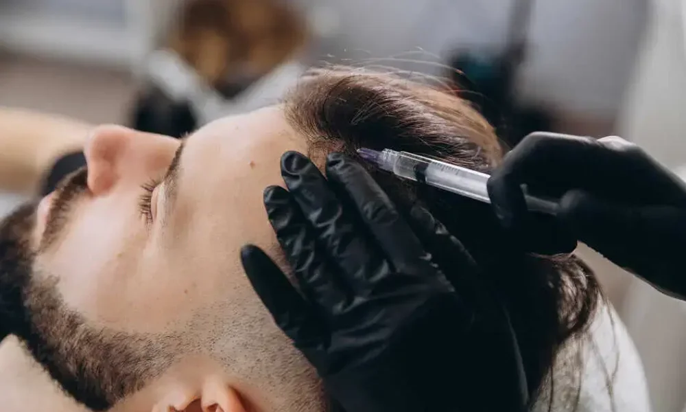 Hair Transplant Treatment by Dash Medical Spa in Delray Beach, FL