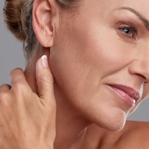 Laser Skin Resurfacing in Delray Beach, FL